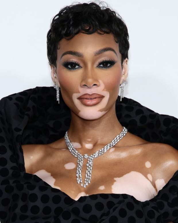 Winnie Harlow
